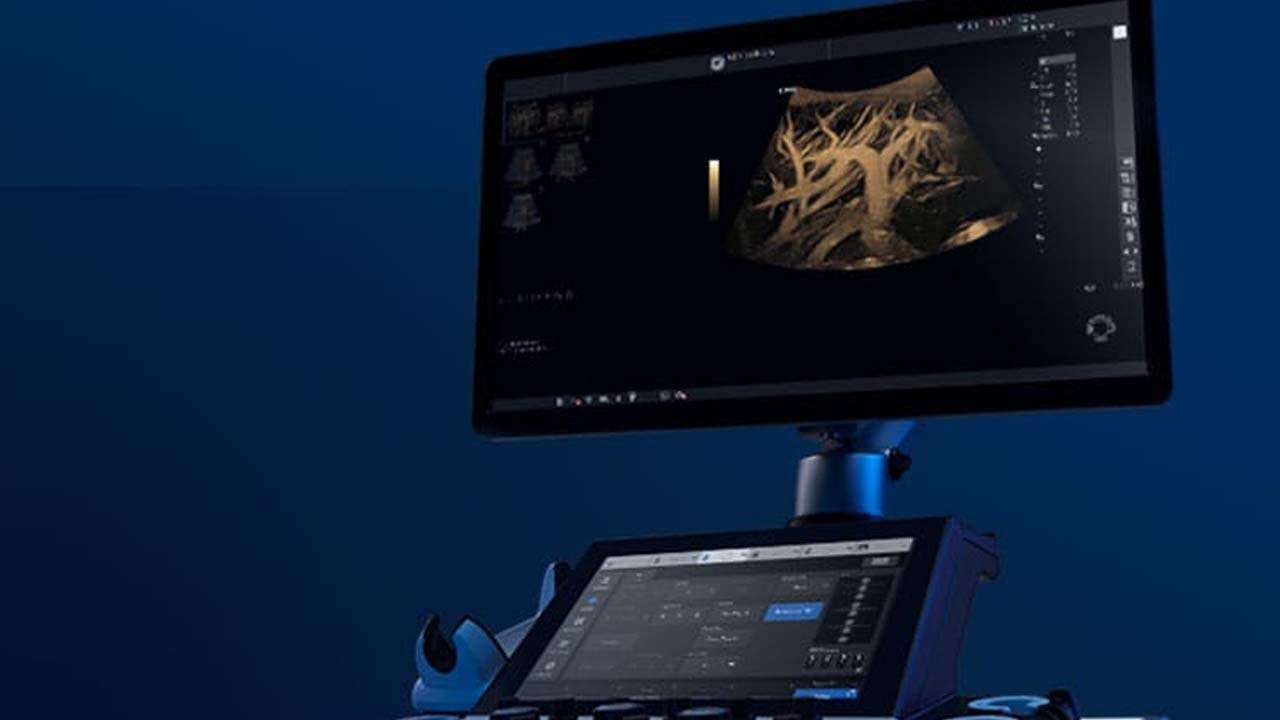 Kalp ve Damar Hastalıklarında Hızlı Tanı: Uşak’a Yeni Doppler Ultrasonlar